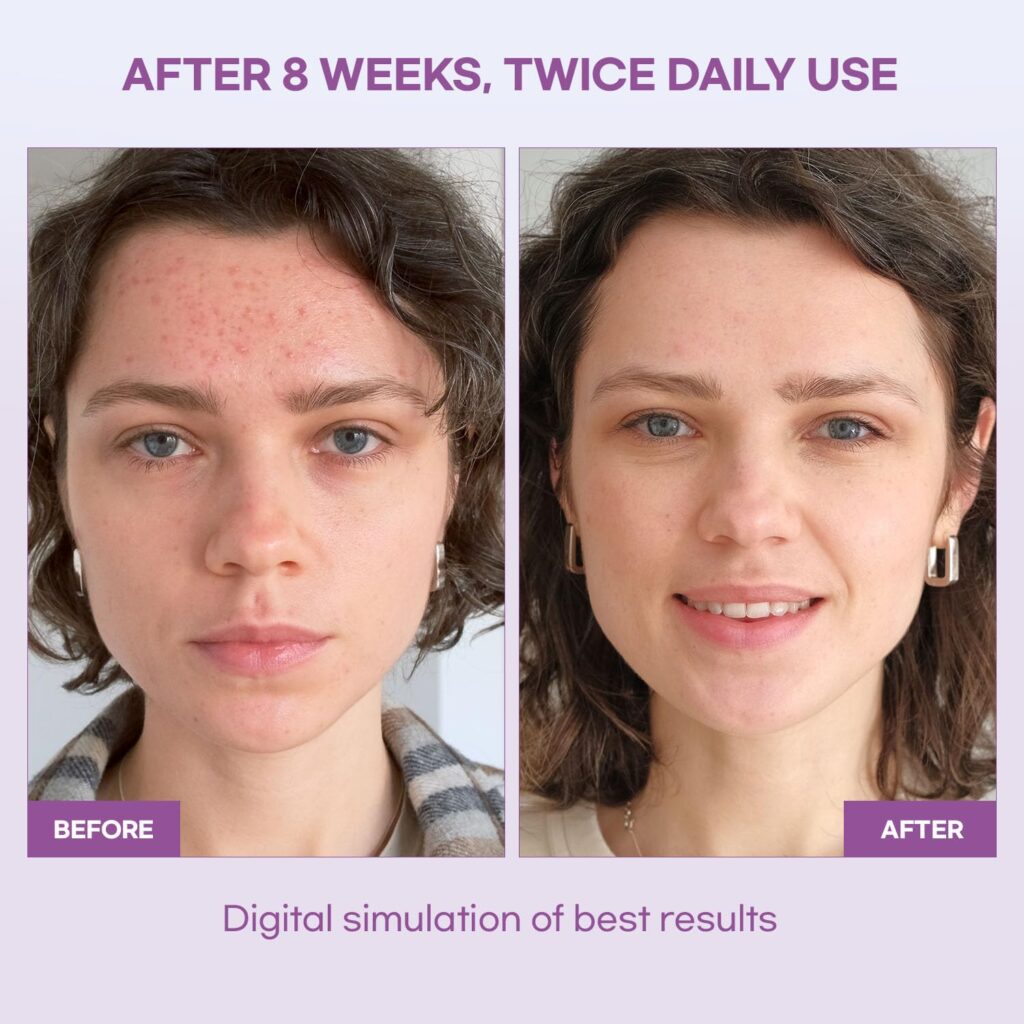 natural-vine-dark-spot-serum 