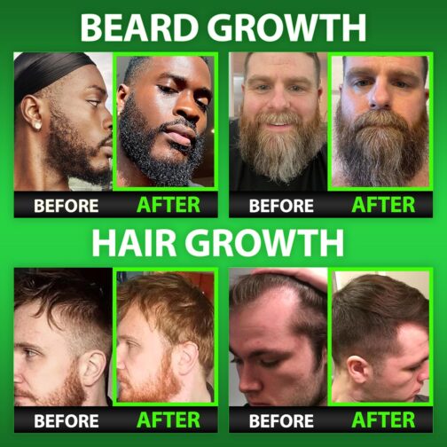 Best Beard Stuff’s Beard & Hair Growth Vitamins for Men | Maximum Strength Biotin Gummies for Thicker Hair & Beard - Image 2