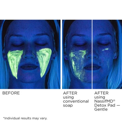 NassifMD Gentle Facial Detox Pads – Daily Cleansing & Exfoliation for Sensitive Skin (60 Pads) - Image 2