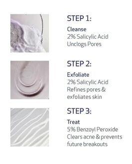 Obagi CLENZIderm M.D. Therapeutic System – Complete 3-Step Acne Treatment with Salicylic Acid & Benzoyl Peroxide