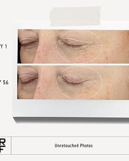 RODAN + FIELDS Redefine Eye Cream – Vitamin C Eye Moisturizer for Puffiness, Wrinkles & Dark Circles
