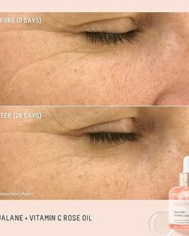 Biossance Squalane and Vitamin C Rose Oil – Brightening & Firming Facial Oil for Radiant, Hydrated Skin – Lightweight, Non-Greasy Glow Booster, 1 Fl Oz