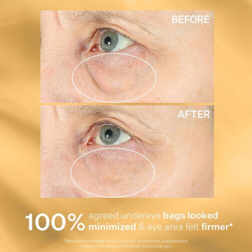StriVectin Hyperlift Eye Cream – Instant Tightening Eye Treatment for Bags, Lines & Puffiness (0.34 Fl Oz) - Image 2