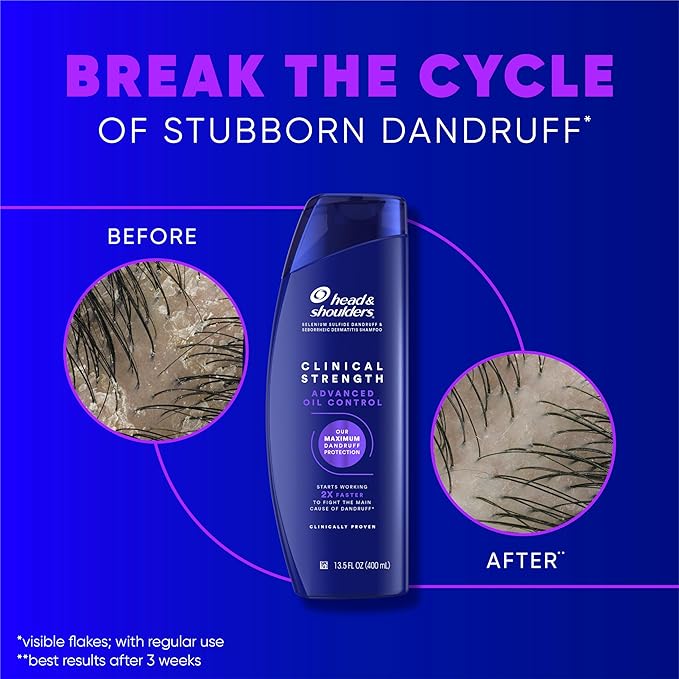 Head & Shoulders Clinical Dandruff Shampoo Twin Pack – 13.5 Fl Oz (Each), Oil & Flake Control, Prescription-Strength Relief for Seborrheic Dermatitis – Citrus Scent - Image 3